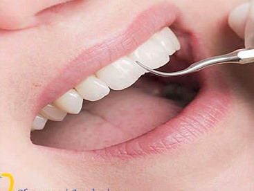 Πρόληψη-Καθαρισμός