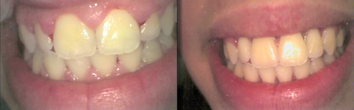 Αισθητική οδοντιατρική