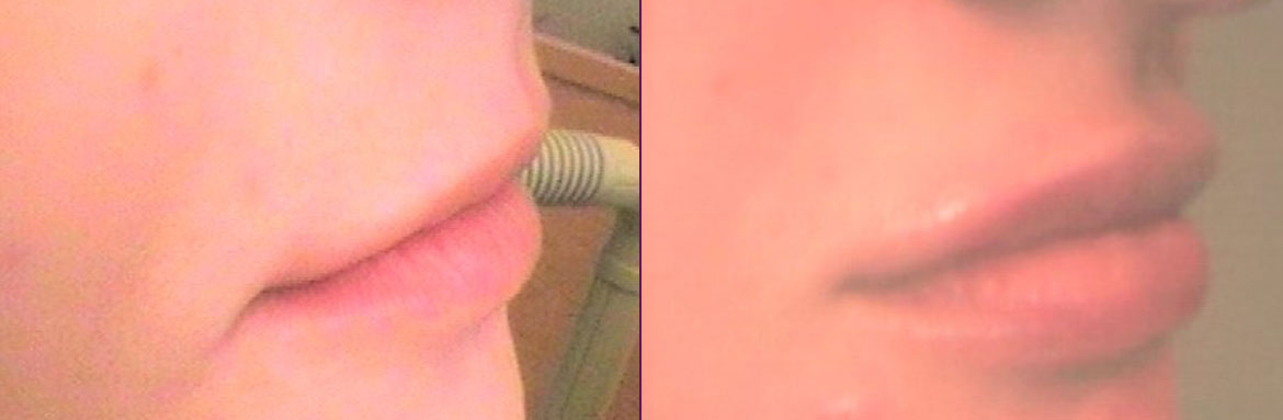 Αισθητική-Προσώπου