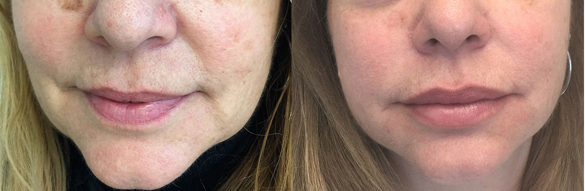 Αισθητική-Προσώπου