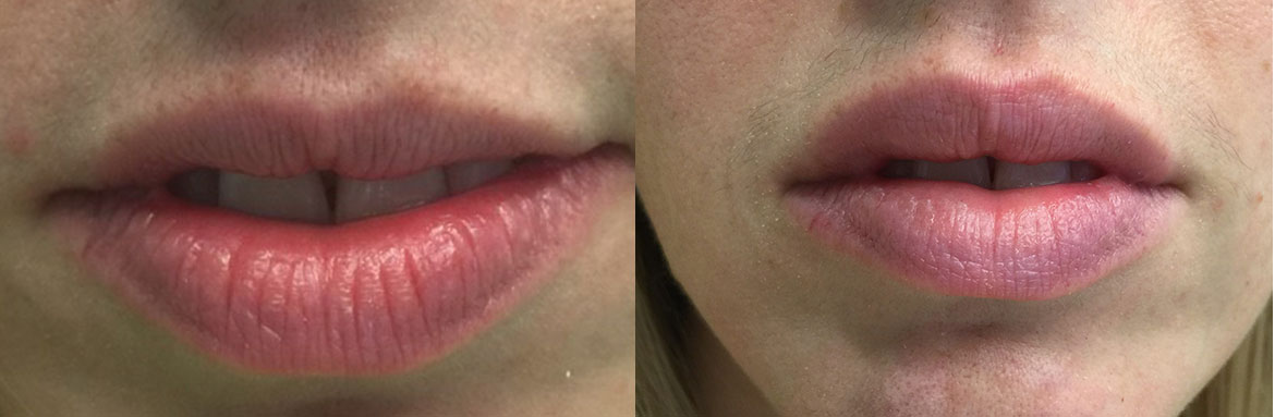 Αισθητική-Προσώπου