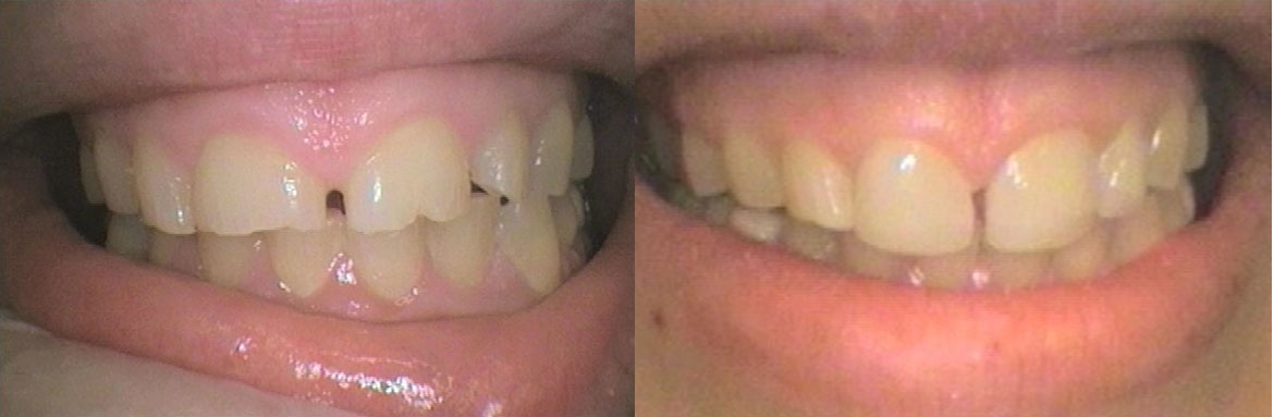 Αισθητική οδοντιατρική