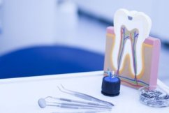 Ενδοδοντική Θεραπεία