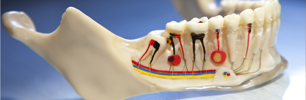 Ενδοδοντική Θεραπεία