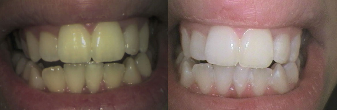 Αισθητική οδοντιατρική