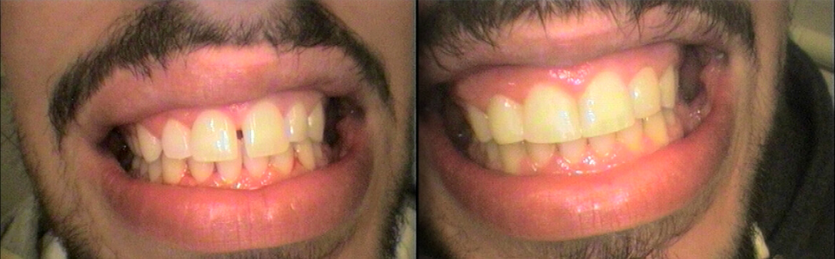 Αισθητική οδοντιατρική