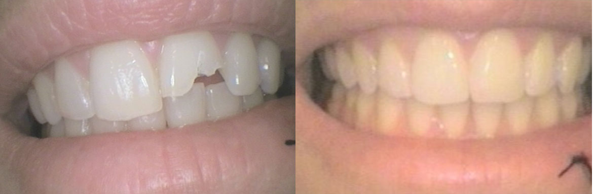 Οδοντική χειρουργική