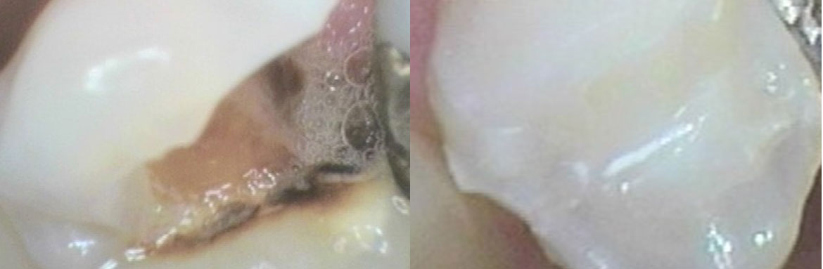 Οδοντική χειρουργική