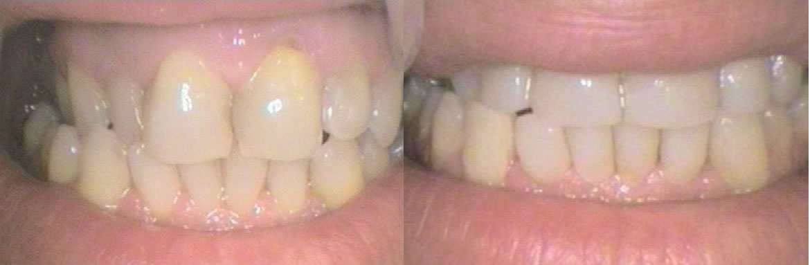 Οδοντική χειρουργική