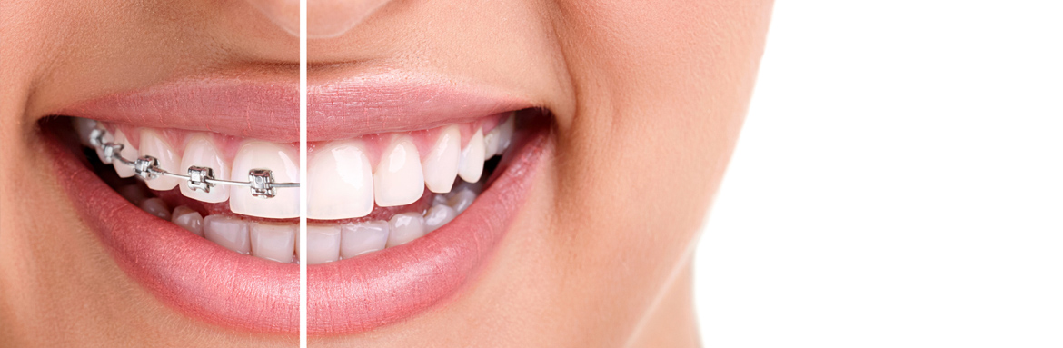 Ορθοδοντική