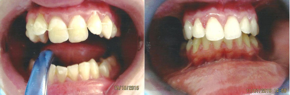 Ορθοδοντική