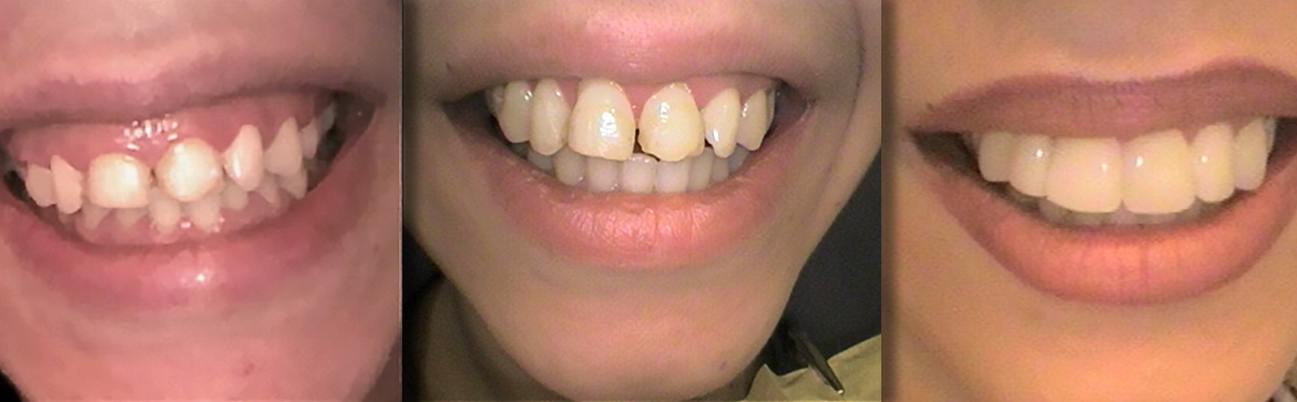 Αισθητική οδοντιατρική