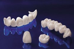 Ακίνητη προσθετική