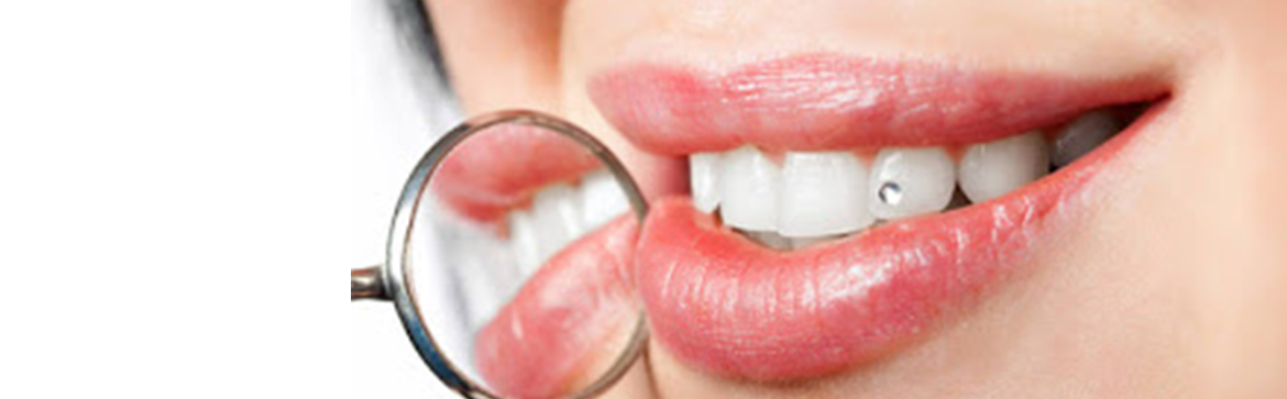 Αισθητική οδοντιατρική