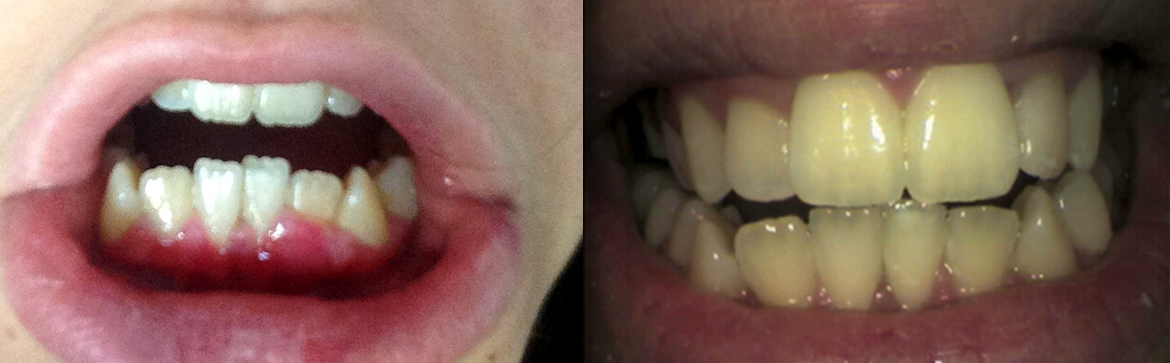 Αισθητική οδοντιατρική